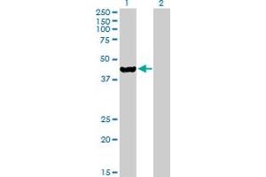 Western Blot analysis of ETNK2 expression in transfected 293T cell line by ETNK2 MaxPab polyclonal antibody. (Ethanolamine Kinase 2 anticorps  (AA 1-386))