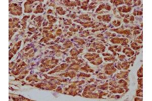 IHC image of ABIN7148801 diluted at 1:100 and staining in paraffin-embedded human pancreatic tissue performed on a Leica BondTM system.