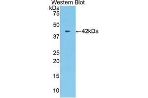 Detection of recombinant CPB2 using Polyclonal Antibody to Carboxypeptidase B2 (CPB2) (CPB2 anticorps  (AA 113-422))