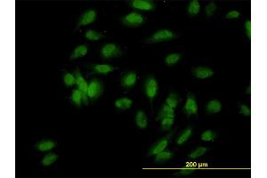 Immunofluorescence of monoclonal antibody to UBE3A on HeLa cell. (ube3a anticorps  (AA 51-150))