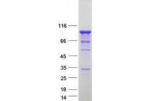 Validation with Western Blot