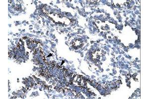 Image no. 2 for anti-TAF7 RNA Polymerase II, TATA Box Binding Protein (TBP)-Associated Factor, 55kDa (TAF7) (N-Term) antibody (ABIN202307)