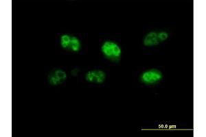 Immunofluorescence of purified MaxPab antibody to FBXO7 on HeLa cell.