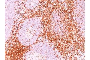 Formalin-fixed, paraffin-embedded human Tonsil (20X) stained with CD6 Monoclonal Antibody (3F7B5).