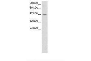 Image no. 3 for anti-FOS-Like Antigen 2 (FOSL2) (AA 208-256) antibody (ABIN6735784)