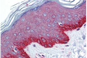 Human Skin: Formalin-Fixed, Paraffin-Embedded (FFPE)