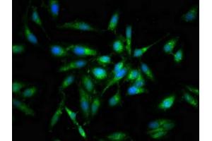 Immunofluorescent analysis of Hela cells using ABIN7165698 at dilution of 1:100 and Alexa Fluor 488-congugated AffiniPure Goat Anti-Rabbit IgG(H+L)