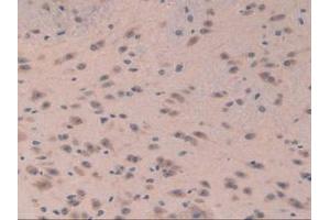 Detection of EIF3A in Mouse Brain Tissue using Polyclonal Antibody to Eukaryotic Translation Initiation Factor 3A (EIF3A)