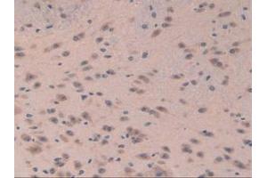 Detection of EIF3A in Mouse Brain Tissue using Polyclonal Antibody to Eukaryotic Translation Initiation Factor 3A (EIF3A) (EIF6 anticorps  (AA 622-848))