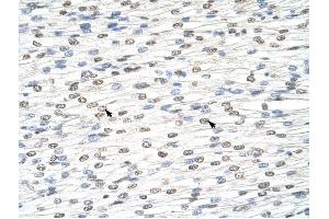 anti-DIS3-Like Exonuclease 2 (DIS3L2) (N-Term) antibody