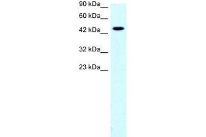Human Jurkat; WB Suggested Anti-SLC17A2 Antibody Titration: 0. (SLC17A2 anticorps  (Middle Region))