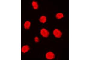Immunofluorescent analysis of MEKK3 staining in Raji cells. (MAP3K3 anticorps  (Center))
