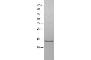 Western Blotting (WB) image for Tumor Necrosis Factor Receptor Superfamily, Member 10b (TNFRSF10B) (AA 52-183) protein (His-IF2DI Tag) (ABIN7125545)