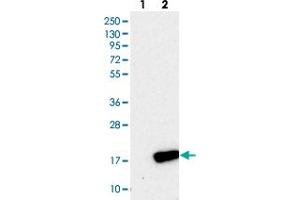 Western blot analysis of Lane 1: Negative control (vector only transfected HEK293T lysate), Lane 2: Over-expression Lysate (Co-expressed with a C-terminal myc-DDK tag (~3. (PLGRKT anticorps)