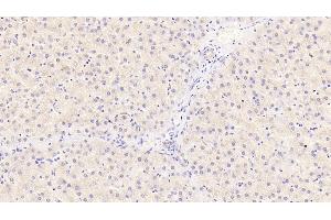 Detection of ST2 in Human Liver Tissue using Monoclonal Antibody to Syntenin 2 (ST2) (SDCBP2 anticorps  (AA 1-292))