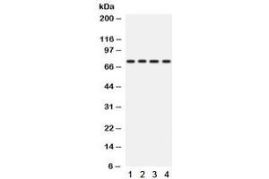 Western blot testing of human 1) A431, 2) A549, 3) HeLa and 4) SKOV lysate with PKC eta antibody. (PKC eta anticorps  (AA 30-389))