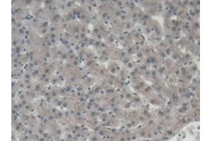 DAB staining on IHC-P; Samples: Porcine Liver Tissue (ORM1 anticorps  (AA 2-171))