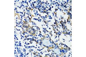 Immunohistochemistry of paraffin-embedded human tonsil using HD antibody (ABIN6133742, ABIN6141675, ABIN6141678 and ABIN6213911) at dilution of 1:100 (40x lens). (HDAC5 anticorps  (AA 550-650))