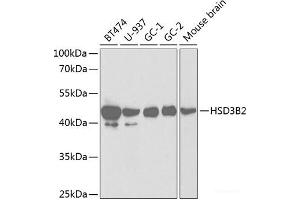 Western blot analysis of extracts of various cell lines using HSD3B2 Polyclonal Antibody at dilution of 1:1000. (HSD3B2 anticorps)
