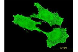 anti-Structural Maintenance of Chromosomes 1B (SMC1B) (AA 551-660) antibody