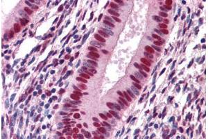 Human Uterus: Formalin-Fixed, Paraffin-Embedded (FFPE) (SAFB anticorps  (AA 111-201))