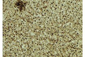 ABIN6273062 at 1/100 staining Mouse liver tissue by IHC-P.