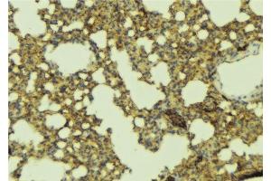 ABIN6277396 at 1/100 staining Mouse lung tissue by IHC-P.