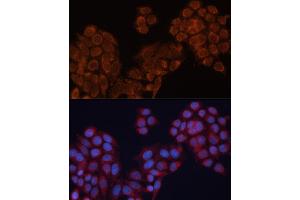 Immunofluorescence analysis of HeLa cells using  antibody (ABIN6127341, ABIN6136780, ABIN6136781 and ABIN6220209) at dilution of 1:100. (ALDH6A1 anticorps  (AA 326-535))