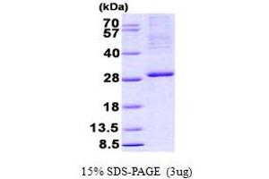 SDS-PAGE (SDS) image for Integrin beta 3 Binding Protein (Beta3-Endonexin) (ITGB3BP) (AA 1-216) protein (His tag) (ABIN6387171)