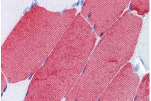 anti-Fast Skeletal Troponin T (TNNT3) antibody