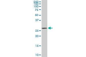 CDK4 monoclonal antibody (M06), clone 6D7. (CDK4 anticorps  (AA 211-303))