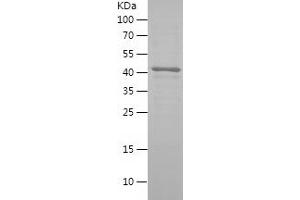 Western Blotting (WB) image for Thioredoxin Interacting Protein (TXNIP) (AA 22-382) protein (His-IF2DI Tag) (ABIN7125361)