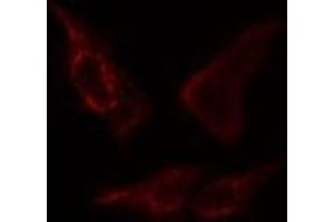 ABIN6276392 staining  COLO205 cells by IF/ICC. (STEAP3 anticorps  (N-Term))