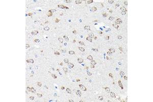 Immunohistochemistry of paraffin-embedded mouse brain using RPS15A Rabbit pAb (ABIN6131092, ABIN6147201, ABIN6147202 and ABIN6214414) at dilution of 1:200 (40x lens).