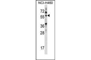 Western blot analysis of MINPP1 Antibody (C-term) in NCI-H460 cell line lysates (35ug/lane). (MINPP1 anticorps  (C-Term))