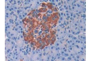 Detection of BCHE in Human Pancreas Tissue using Polyclonal Antibody to Butyrylcholinesterase (BCHE)