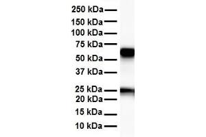 WB Suggested Anti-SLC33A1 antibody Titration: 1 ug/mL Sample Type: Human heart