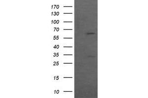 Image no. 2 for anti-Chaperonin Containing TCP1, Subunit 8 (Theta)-Like 2 (CCT8L2) antibody (ABIN1497482) (CCT8L2 anticorps)
