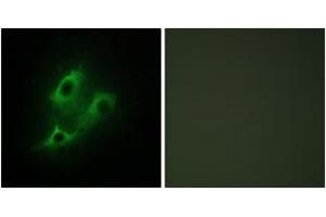 Immunofluorescence analysis of NIH-3T3 cells, using SERC2 Antibody. (PSAT1 anticorps  (AA 341-390))