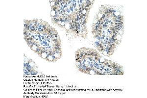 Rabbit Anti-NOL6 Antibody  Paraffin Embedded Tissue: Human Intestine Cellular Data: Epithelial cells of intestinal villas Antibody Concentration: 4. (Nucleolar Protein 6 anticorps  (C-Term))
