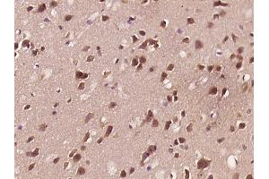 Paraformaldehyde-fixed, paraffin embedded mouse brain, Antigen retrieval by boiling in sodium citrate buffer (pH6) for 15min, Block endogenous peroxidase by 3% hydrogen peroxide for 30 minutes, Blocking buffer (normal goat serum) at 37°C for 20min, Antibody incubation with APBB1 (Ser175) Polyclonal Antibody, Unconjugated  at 1:400 overnight at 4°C, followed by a conjugated secondary and DAB staining.