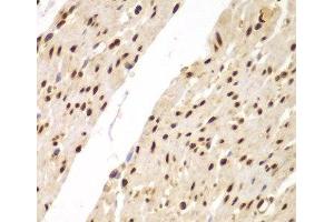 Immunohistochemistry of paraffin-embedded Human colon using SUPT20H Polyclonal Antibody at dilution of 1:100 (40x lens). (FAM48A/P38IP anticorps)