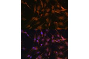 Immunofluorescence analysis of C6 cells using PSMD13 Polyclonal Antibody (ABIN6132189, ABIN6146337, ABIN6146339 and ABIN6222707) at dilution of 1:100 (40x lens).