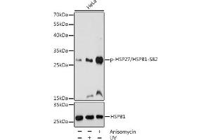 Western blot analysis of extracts of HeLa cells, using Phospho-HSP27/HSPB1-S82 pAb (ABIN3023549, ABIN3023550, ABIN3023551 and ABIN6225403) at 1:1000 dilution or HSP27/HSPB1 antibody (ABIN7267568).