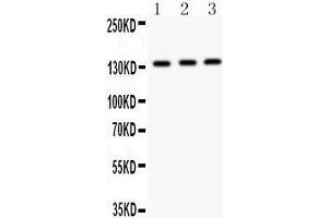 Anti- IRS1 antibody, Western blotting All lanes: Anti IRS1  at 0.