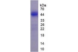 Image no. 2 for Lemur Tyrosine Kinase 3 (LMTK3) (AA 133-411) (Active) protein (His tag) (ABIN6239743)