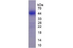 LMTK3 Protein (AA 133-411) (His tag)