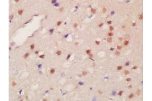 Formalin-fixed and paraffin embedded rat brain labeled with Rabbit Anti-JMJD2B(Thr305) Polyclonal Antibody, Unconjugated  at 1:200 followed by conjugation to the secondary antibody and DAB staining (KDM4B anticorps  (pThr305))