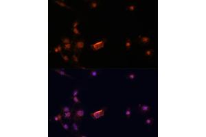 Immunofluorescence analysis of C6 cells using BRC antibody (435) at dilution of 1:100.