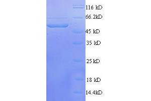 Transcriptional Adaptor 3 (TADA3) (AA 1-238), (partial) protein (GST tag)